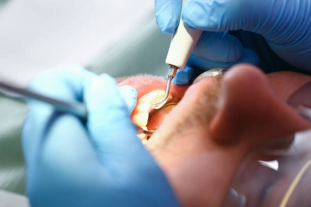 Best Emergency Tooth Extraction in South Haven, MI